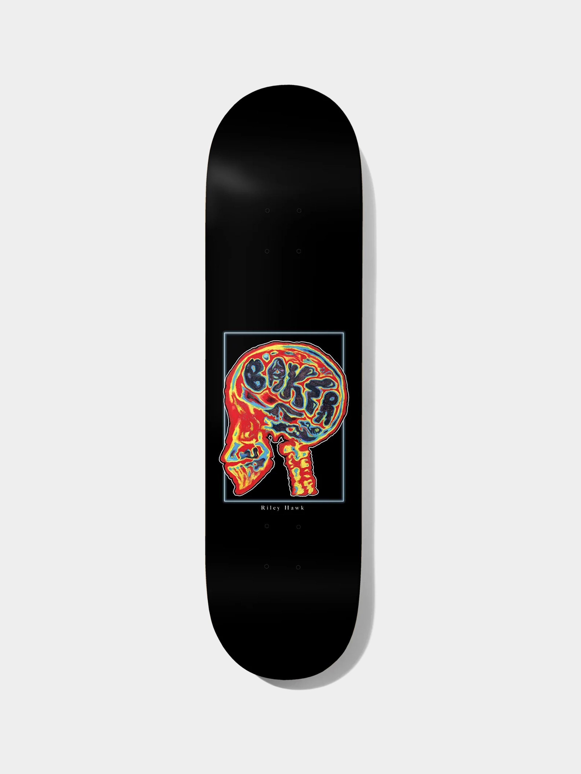 Deck Baker RH Brain Donor